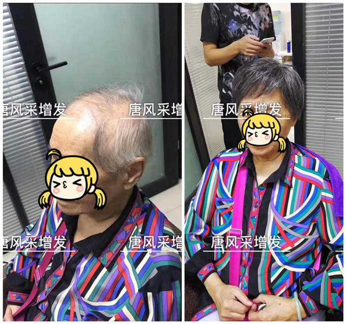 染發好還是戴假發好 \
