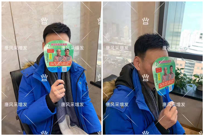 戴假發的人多嗎 \