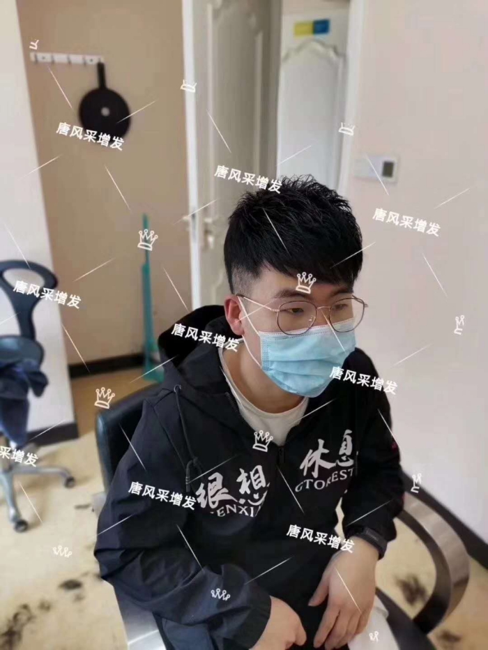 發片佩戴效果 \