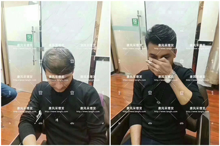 發片佩戴效果 \