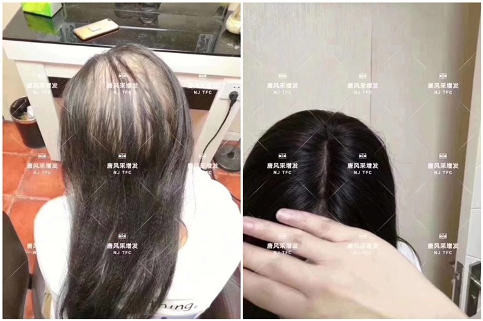 唐風采增發 \