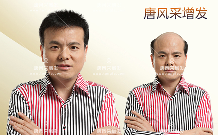 夏天帶假發熱嗎 \