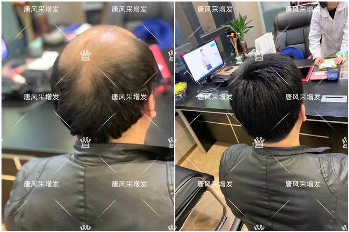 夏天帶假發熱嗎 \