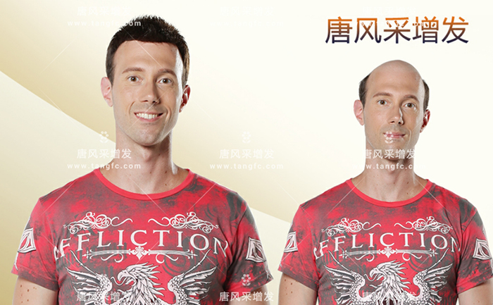 如何購(gòu)買假發(fā) \