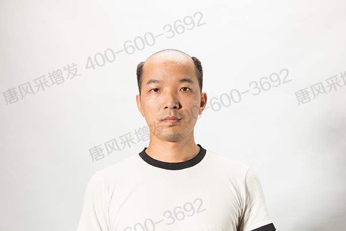 購(gòu)買假發(fā) \