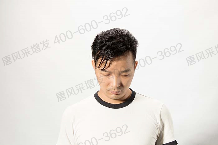 如何購(gòu)買假發(fā) \