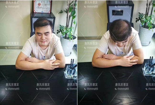 如何購(gòu)買假發(fā) \