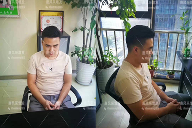 如何購(gòu)買假發(fā) \