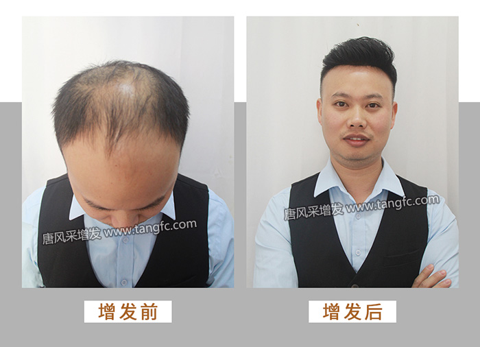 男士假發背頭 \