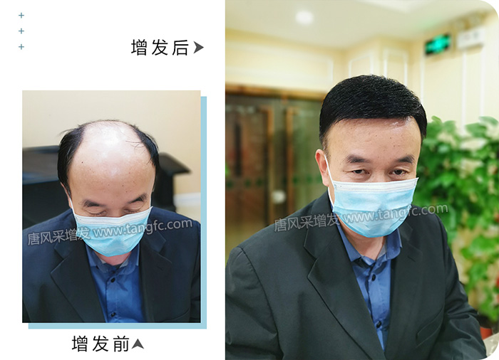 定制假發 \