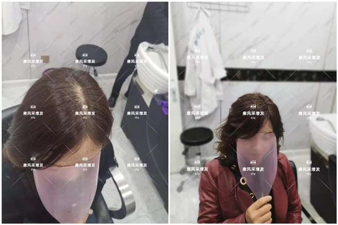 假發定制 \