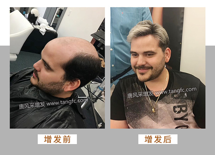 唐風采增發 \
