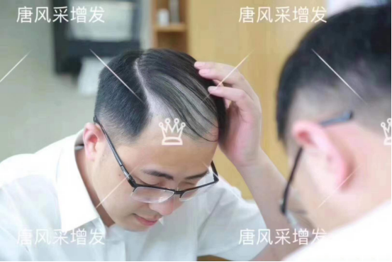 隱形假發 \