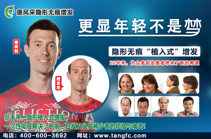 隱形假發 \