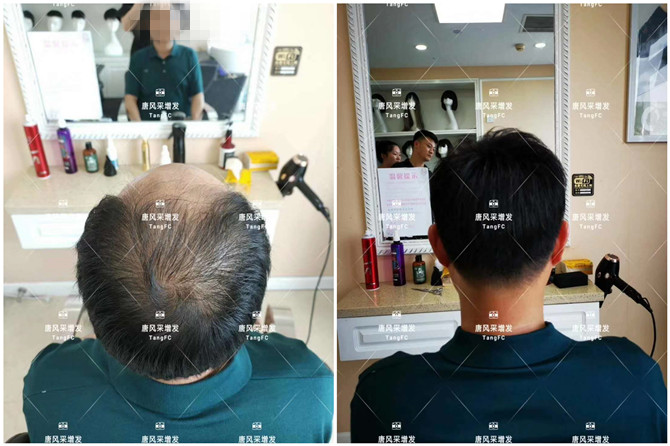 男士假發片 \