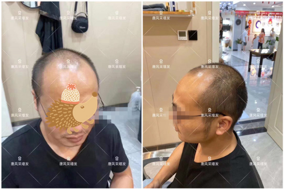 男士假發片 \