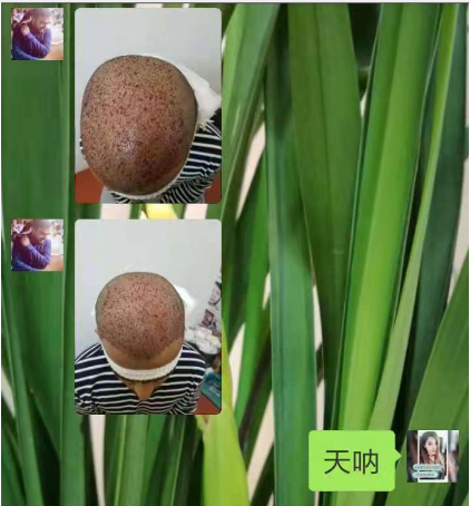 真人發假發 \