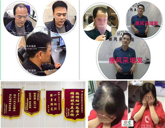 男士定做假發 \