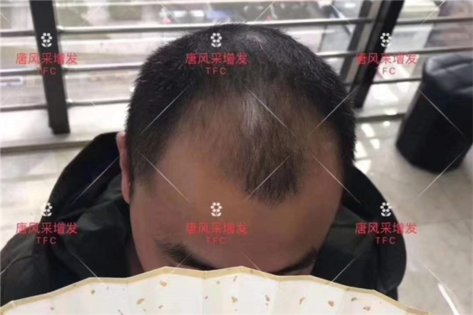 男士定做假發 \