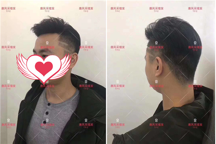 定做假發 \