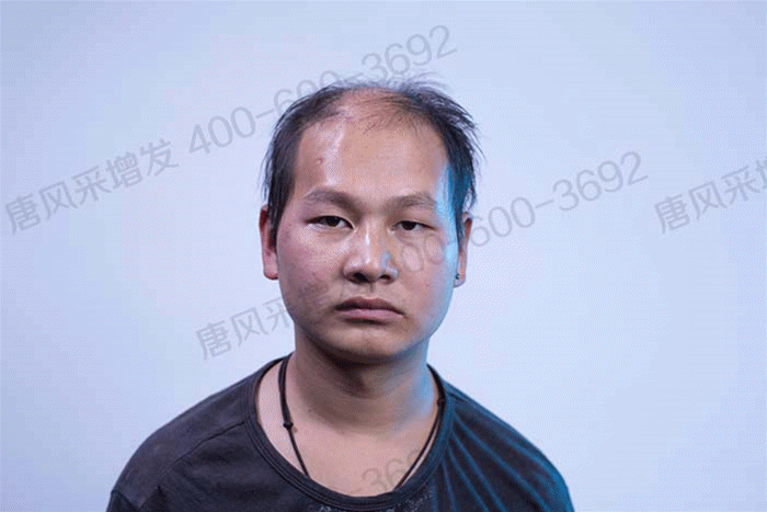 要不要做隱形增發 \