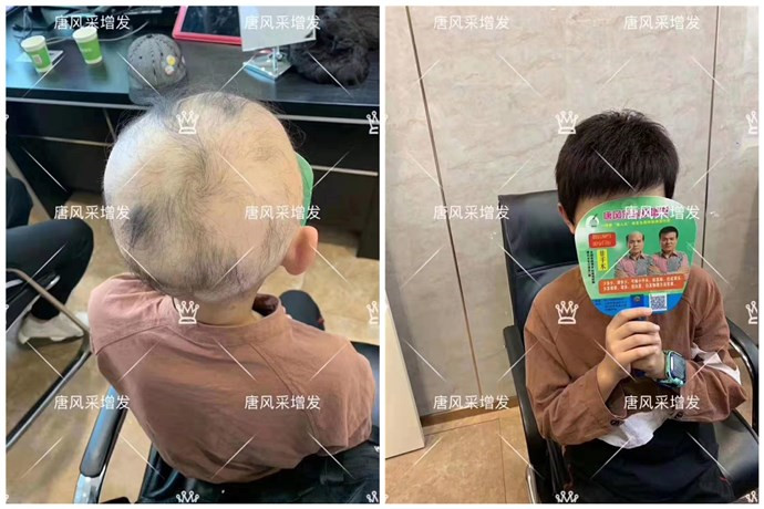 要不要做隱形增發 \