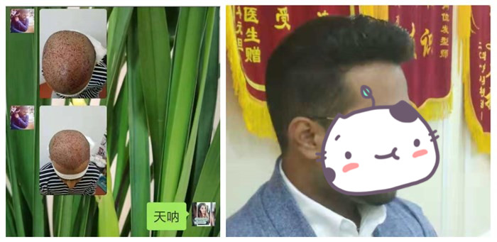 要不要做隱形增發 \