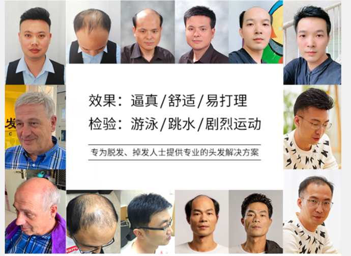 貼局部假發 \