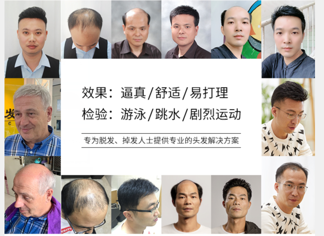 假發片頭頂補發片 \