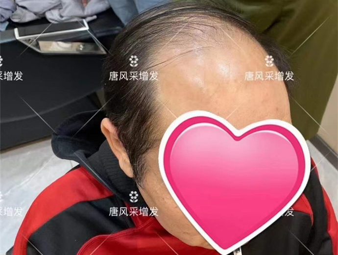 中年男士假發 \