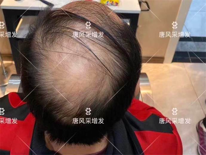 中年男士假發 \