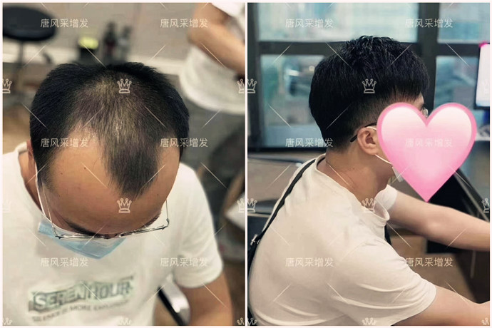 假發什么品牌好 \