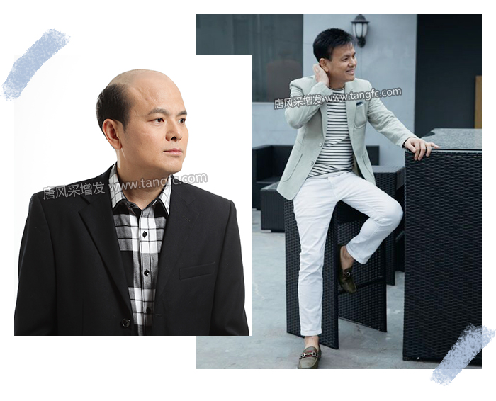 男士逼真假發 \