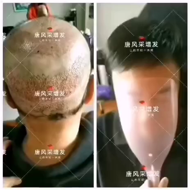 假發經濟 \