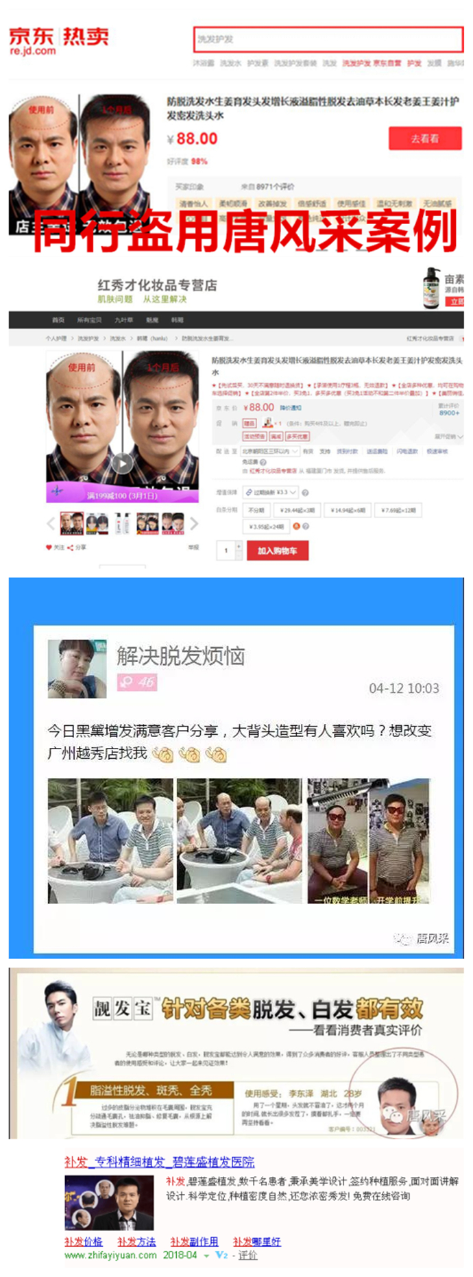 頭發少做織發補發 \