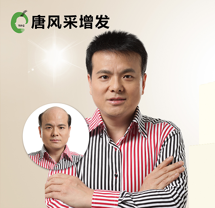 頭發少做織發補發 \