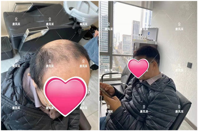 看臉型定做假發 \