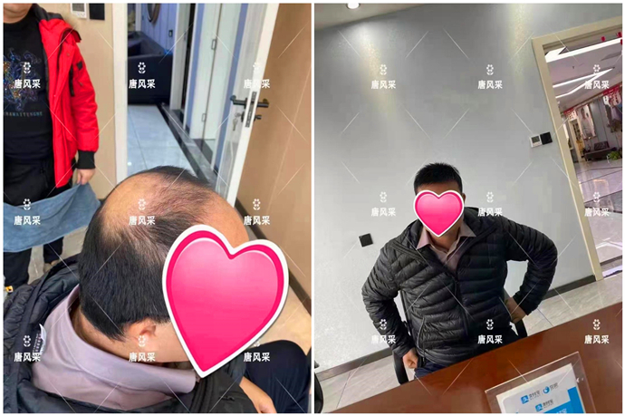 看臉型定做假發 \