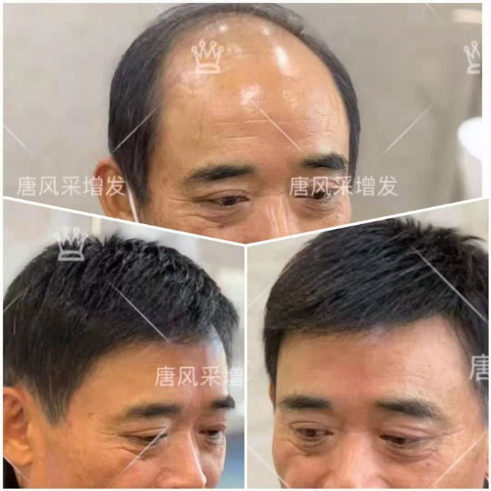 假發圖片 \