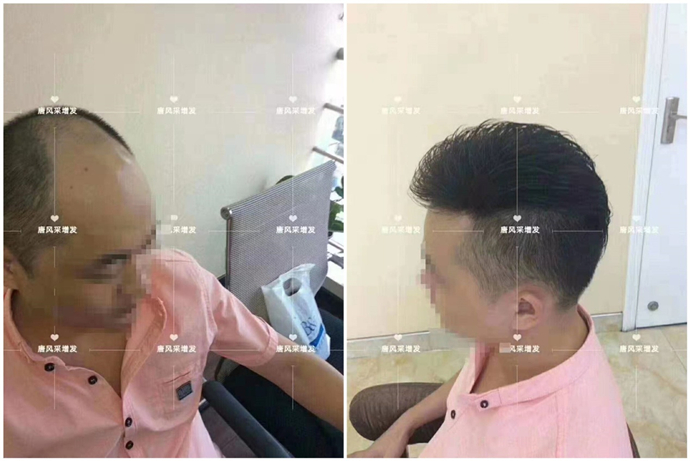 男士高級假發 \