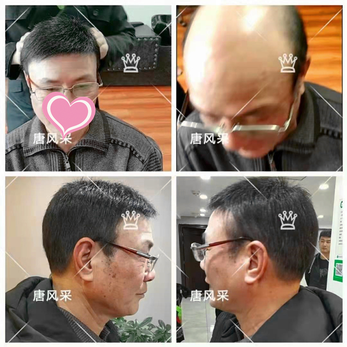 購買假發需要注意什么 \