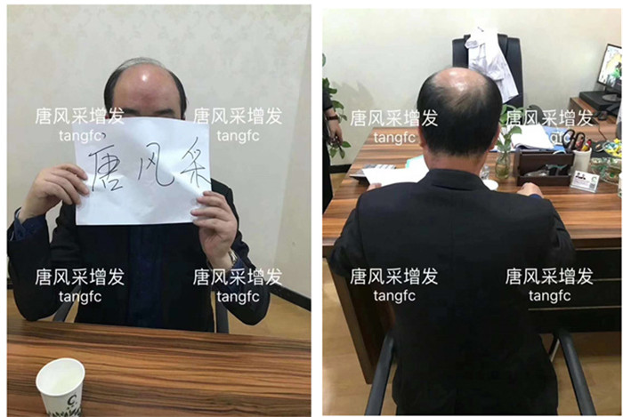 假發套一般價格多少錢 \