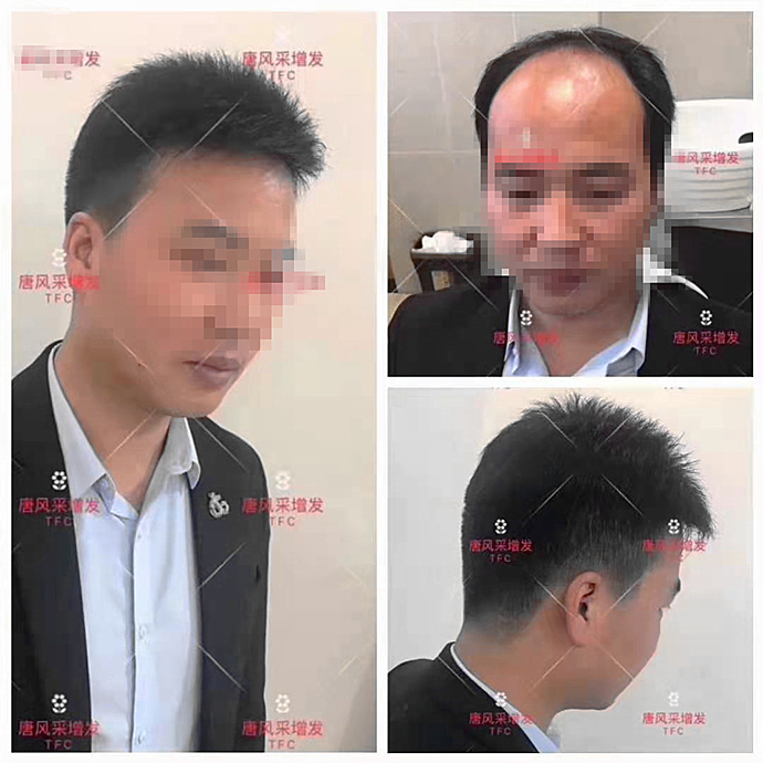 怎樣戴假發更好看 \