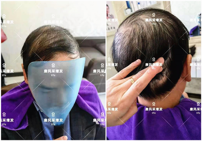 買男士假發 \