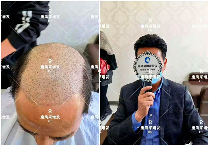買男士假發 \