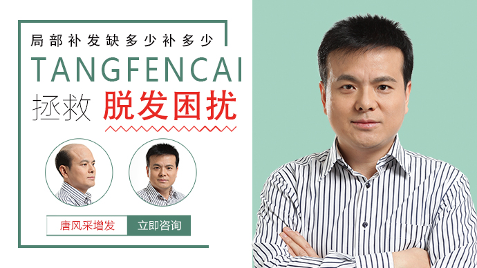 真發假發品牌哪家好 \