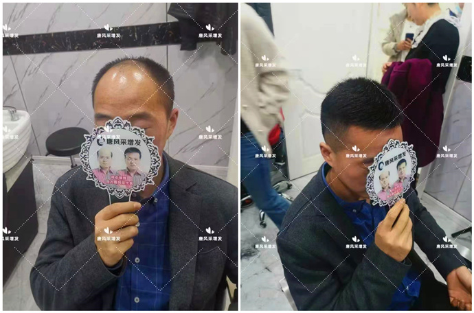 真發假發品牌哪家好 \