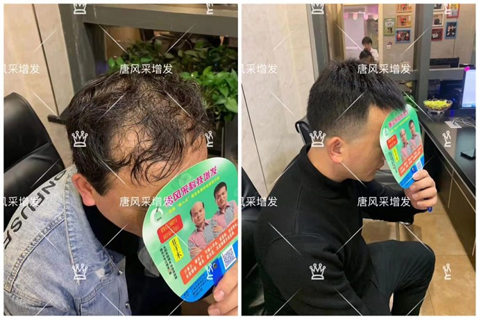 真發假發品牌哪家好 \
