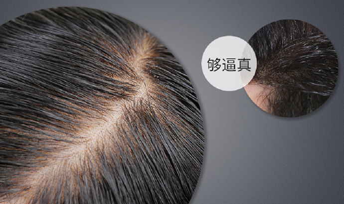 禿頂如何增發 \