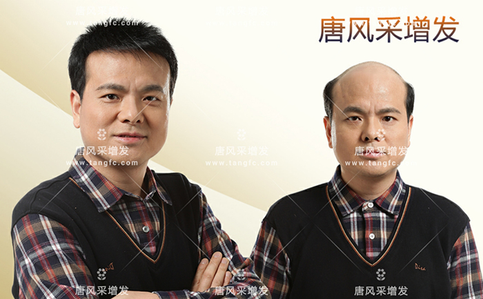 專業男士假發 \